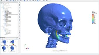 roth mcfarlane hand and upper limb centre reviews|The Effect of Forearm Position on Wrist Joint Biomechanics.